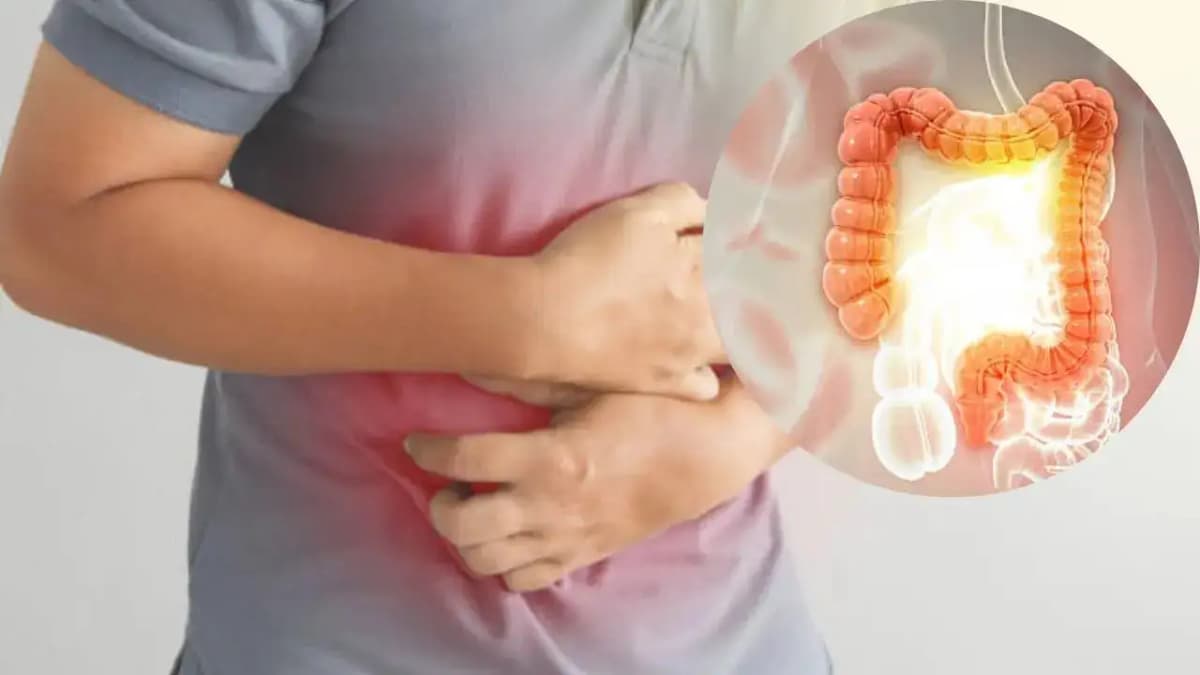 Understanding Summer Stomach Issues: A Warning for Ulcerative Colitis