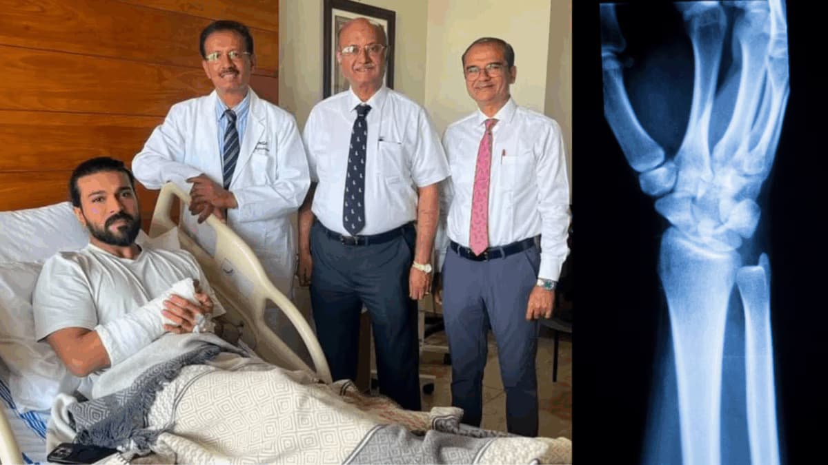 Ram Charan Recovers from Wrist Surgery: What to Expect in 8 Weeks
